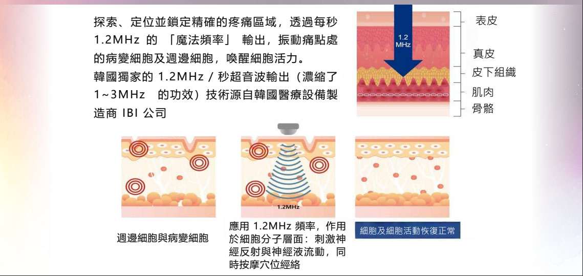 超聲波探頭使用方式